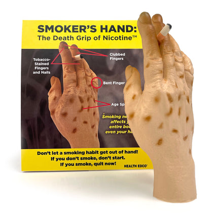 Smoker's Hand: The Death Grip of Nicotine Model, health education tobacco teaching tool with tent card, Health Edco, 27034