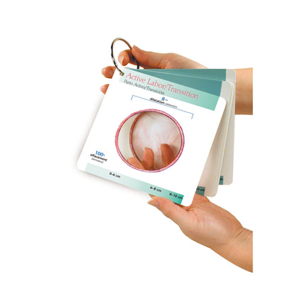 Labor Progress Pocket Guide, active labor transition illustrated dilation cut outt 8 centimeters, Childbirth Graphics, 38826