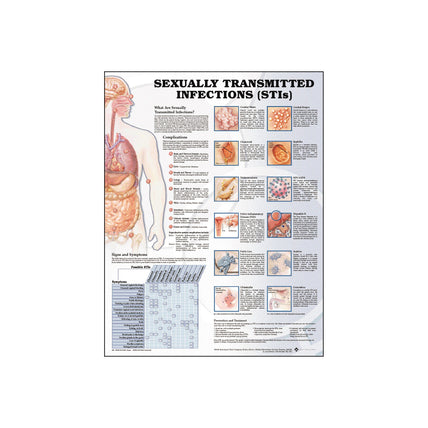 Anatomy Chart: Sexually Transmitted Infections