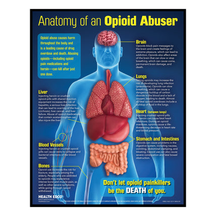 Anatomy of an Opioid Abuser 3-D health education display, opioid drug education materials and models, Health Edco, 78883
