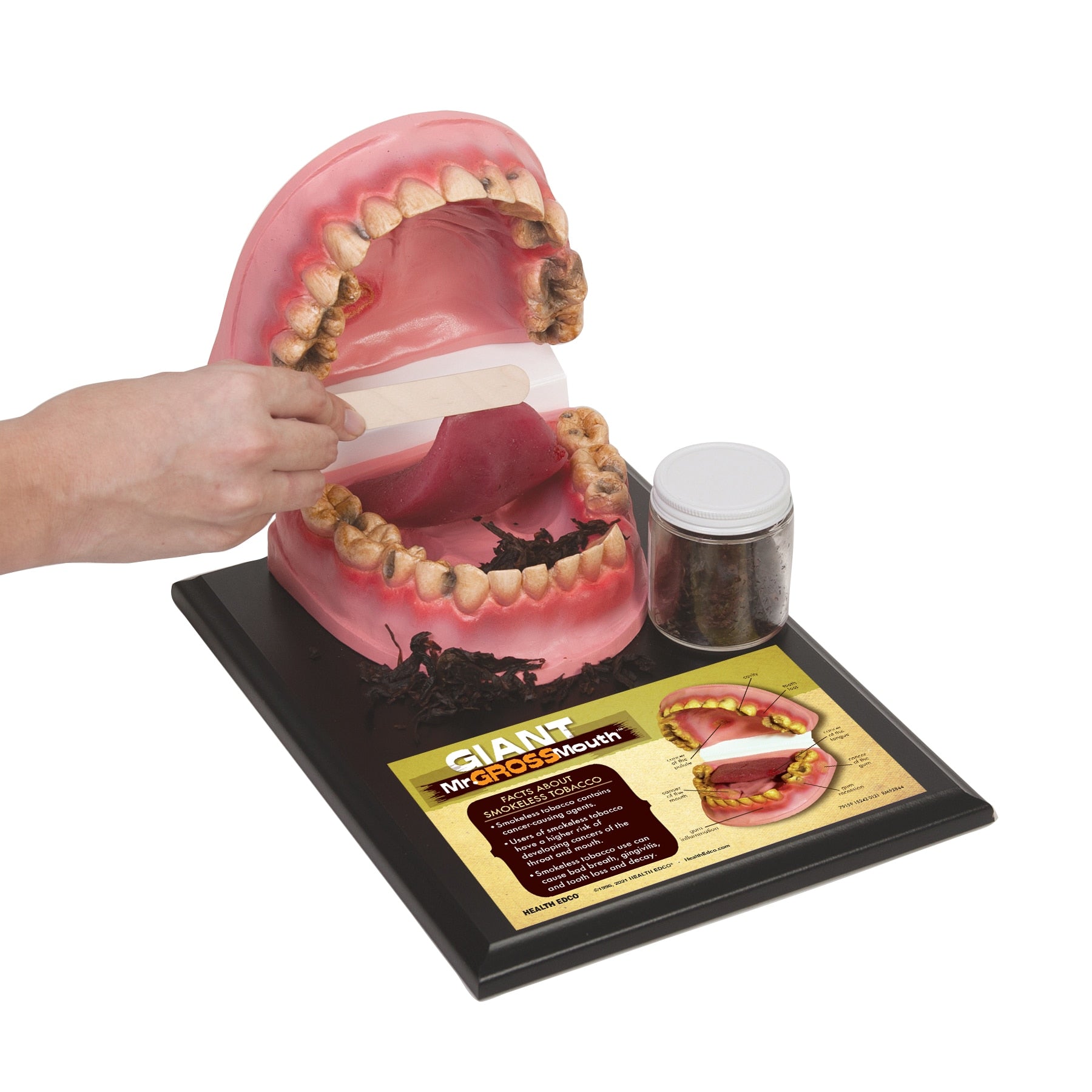 Giant Mr Gross Mouth | Health Edco | Tobacco Education Model