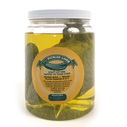 Pickled Liver Model