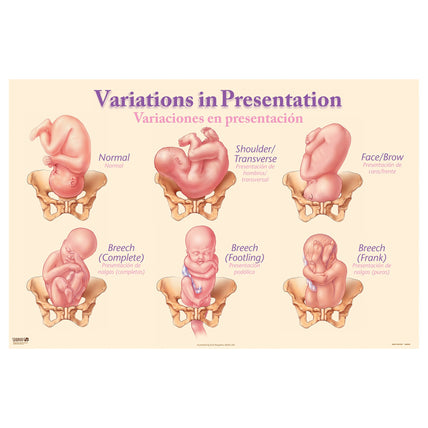 Variations in Presentation Chart depicting different fetal birth presentations, Childbirth Graphics educational chart, 90836