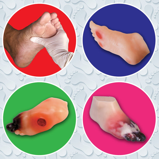 Preventing the Agony of the Feet