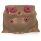 Ostomy Care Model, Brown, for health education and training, brown lifelike torso model with four stomas, Health Edco 26132