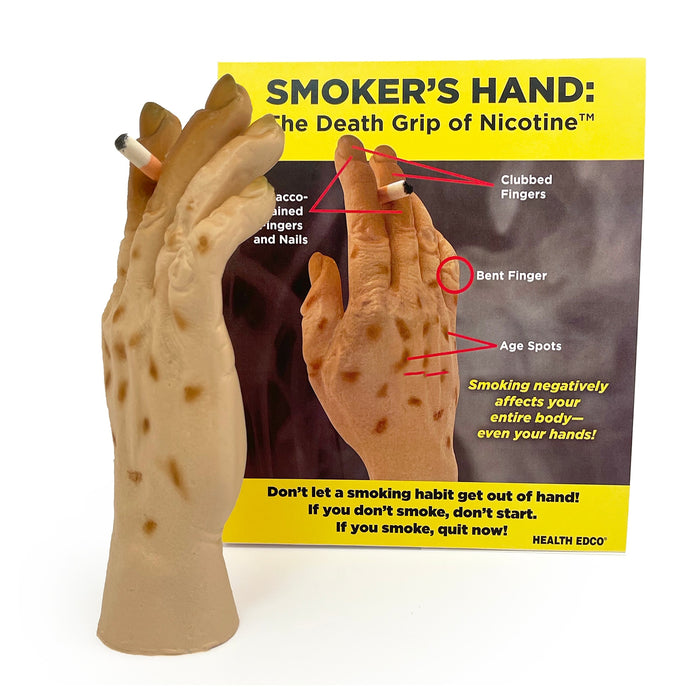 Smoker's Hand: The Death Grip of Nicotine Model, health education tobacco teaching tool with tent card, Health Edco, 27034