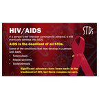 HIV / AIDS slide from STDs PowerPoint, health and sex education PowerPoint on CD-ROM, Health Edco teaching tools, 30272