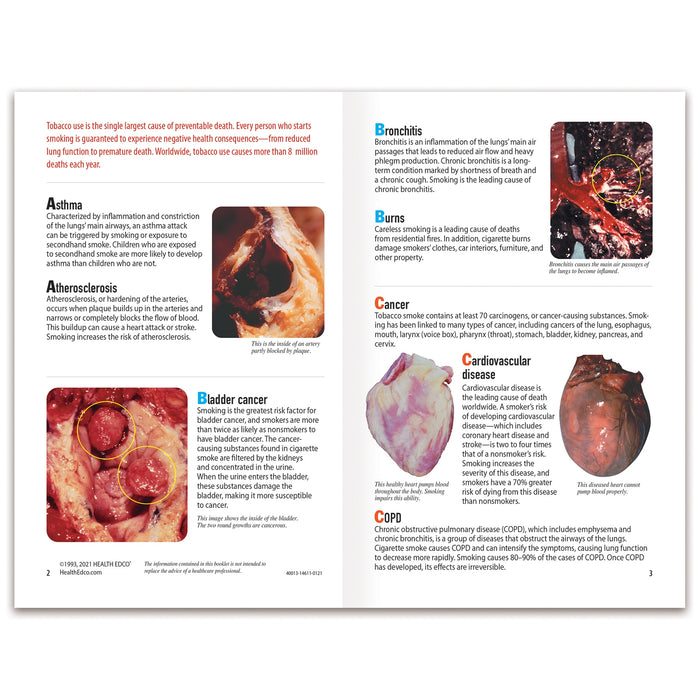 The ABCs of Smoking Booklet, 16-page health and tobacco education resource from Health Edco on diseases from smoking, 40013