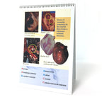 The ABCs of Smoking 6-panel spiral-bound flip chart English version photos of organs list of A through C, Health Edco, 43107