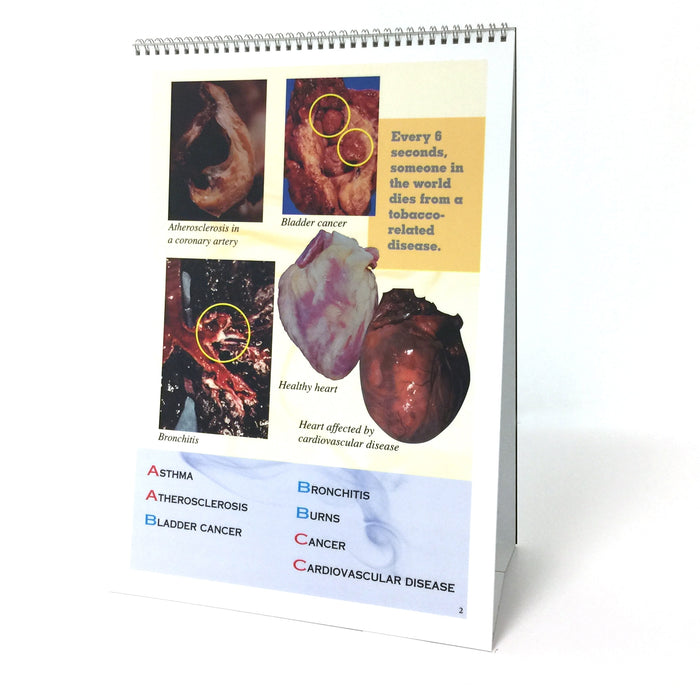 The ABCs of Smoking 6-panel spiral-bound flip chart English version photos of organs list of A through C, Health Edco, 43107