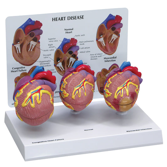 Heart Disease Model Set