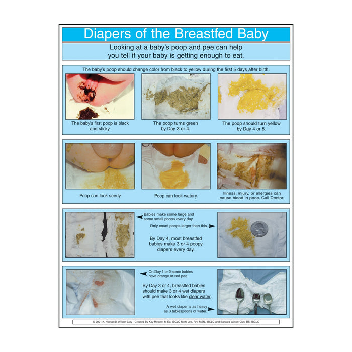 Diapers of the Breastfed Baby full color photo tear pad, colors of breastfed stool, Childbirth Graphics 52741