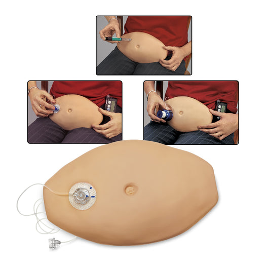 Injection Belly