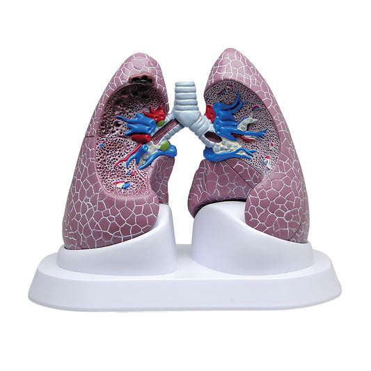 Lung Model Set with Pathologies
