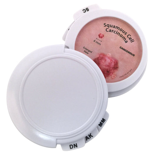 Skin Cancer Disk Set