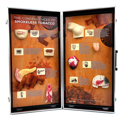 Smokeless Tobacco Consequences 3-D Display, health education display with tobacco diseased organ models, Health Edco, 78817