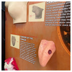 Smokeless Tobacco Consequences 3-D Display, closeup of health education display of tongue cancer model, Health Edco, 78817