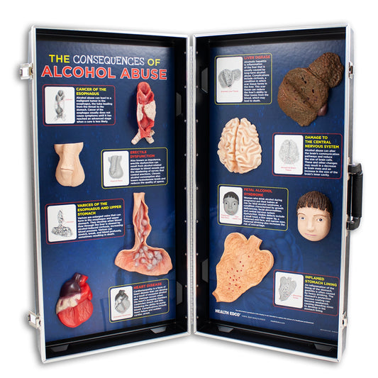Alcohol Abuse Consequences 3-D Display, health education display of physical effects of alcohol abuse, Health Edco, 78879
