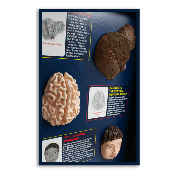 Alcohol Abuse Consequences 3-D Display, health education display, close-up of sculpted painted models, Health Edco, 78879