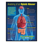 Anatomy of an Opioid Abuser 3-D health education display, opioid drug education materials and models, Health Edco, 78883