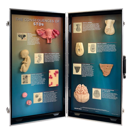STDs Consequences 3-D Display, health education display showing effects of sexually transmitted diseases, Health Edco, 78926