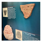 STDs Consequences 3-D Display, models of liver disease and syphilis of the brain in health teaching tool, Health Edco, 78926