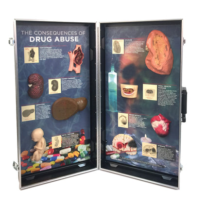 Drug Abuse Consequences 3-D Display from Health Edco with 3-D organ models to depict the health effects of drug abuse, 78928