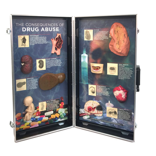 Drug Abuse Consequences 3-D Display from Health Edco with 3-D organ models to depict the health effects of drug abuse, 78928