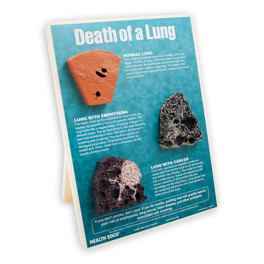 Death of a Lung educational easel display from Health Edco with models of a normal, emphysematous, and cancerous lung, 79148