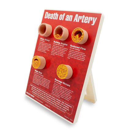 Death of an Artery Easel Display for heart health education by Health Edco with artery models depicting plaque buildup, 79149