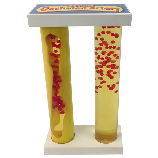 Deluxe Occluded Artery Model