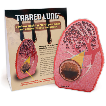 Tarred Lung Model, health education lung model to deter smoking with educational tent card, Health Edco teaching tools, 79234
