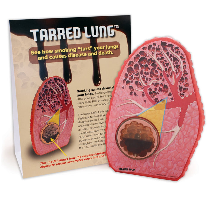 Tarred Lung Model, health education lung model to deter smoking with educational tent card, Health Edco teaching tools, 79234