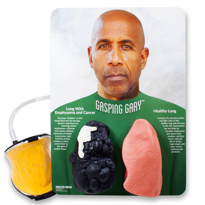 Gasping Gary Smoker's Lungs Comparison Model, male model with dark skin tone with inflatable lung models, Health Edco, 79555