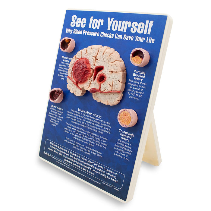See for Yourself Blood Pressure Checks Easel Display for health education by Health Edco with brain and artery models, 79736