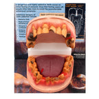 Meth Mouth: An Inside Look Display for health education by Health Edco, mouth model showing oral damage of meth abuse, 79758