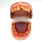 Meth Mouth: An Inside Look Display for health education by Health Edco, mouth model showing oral damage of meth abuse, 79758