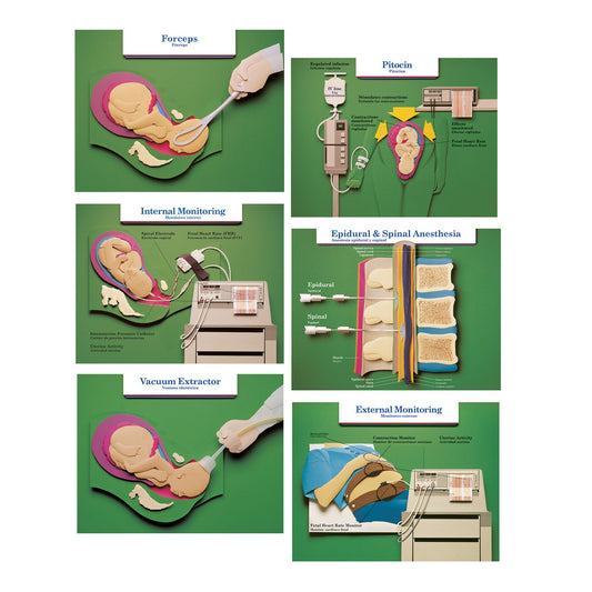 Labor and Birth Intervention Chart Set, six childbirth education charts with a paper art 3D look, Childbirth Graphics, 90615