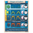 Stages of Labor Chart for childbirth education from Childbirth Graphics, English text with pictorial illustrations, 90620