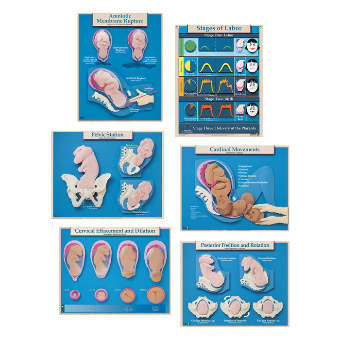 Six Essential Labor and Birth Charts (6), English/Spanish, childbirth education charts, Childbirth Graphics, 90630